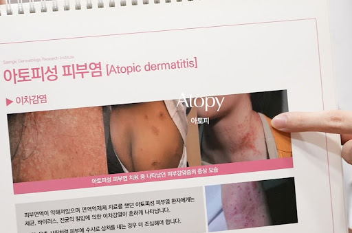 생기한의원 아토피 정보에서 확인하는 피부 건조와 가려움